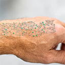 NANOPARTICLES MADE FROM MARINE POLYMERS FOR CUTANEOUS DRUG DELIVERY APPLICATIONS