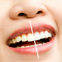 SYNCHROTRON LIGHT FOR FASTER AND MORE EFFECTIVE TOOTH WHITENING TREATMENTS